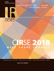 IRnews